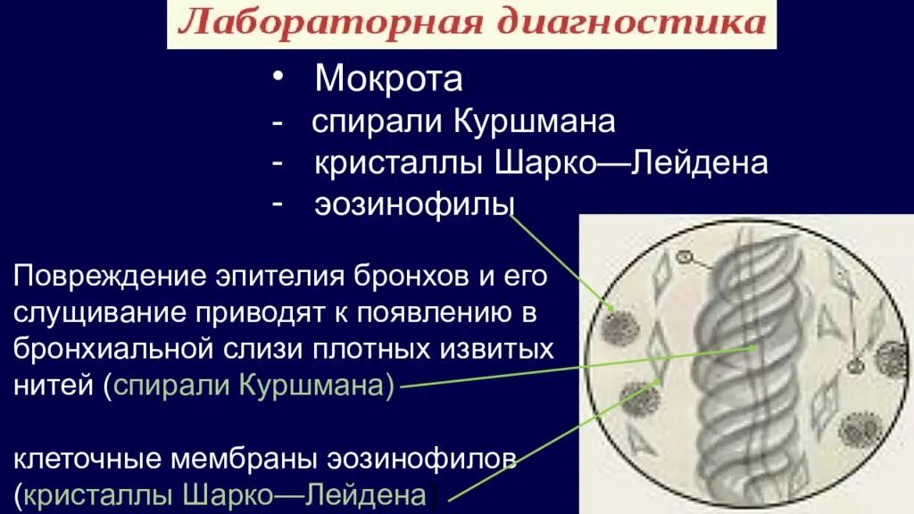 Кристаллы куршмана в мокроте. Спирали Куршмана и Кристаллы Шарко-Лейдена. Кристаллы Шарко Лейдена бронхиальная астма. Анализ мокроты на спирали Куршмана и Кристаллы Шарко-Лейдена. Спирали Куршмана Кристаллы Шарко- Лейдена при бронхиальной астме.