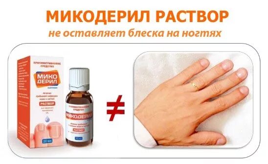 Микодерил инструкция по применению отзывы. Микодерил раствор. микодерил лак от грибка ногтей. раствор от грибка. капли от грибка ногтя микодерил.