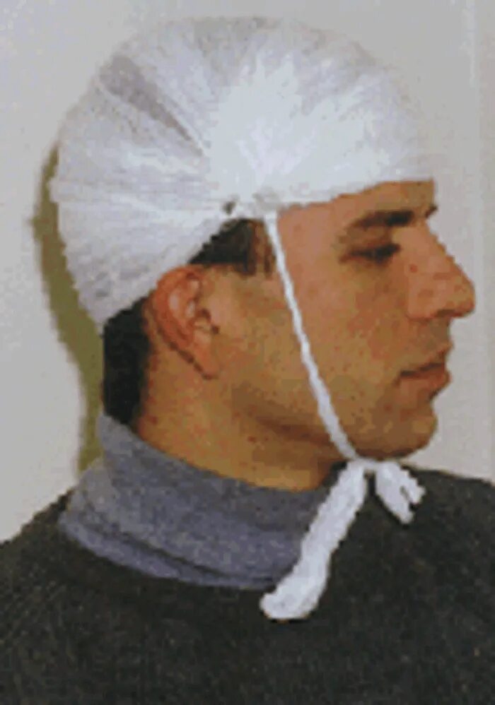 Повязка гиппократа техника наложения. Чепец и шапочка Гиппократа. Чепец Гиппократа повязка. Шапочка Гиппократа повязка.