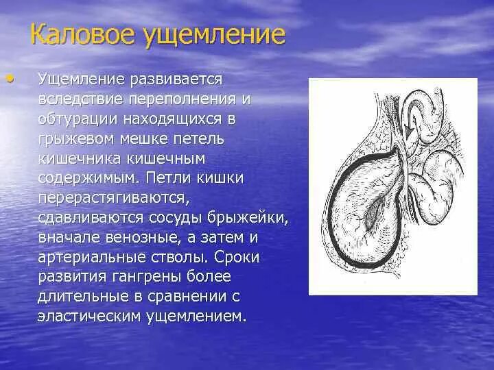 Вызов внешнего ущемления