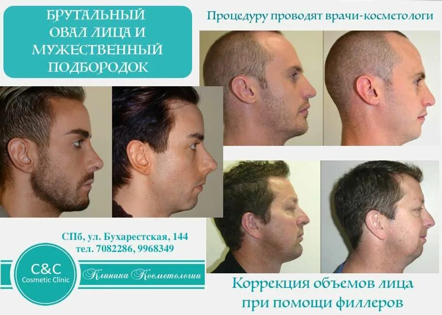 Форма подбородка. Подбородок по высоте криминалистика. Типы подбородков у женщин. Типы формы подбородков. Высота подбородка криминалистика.