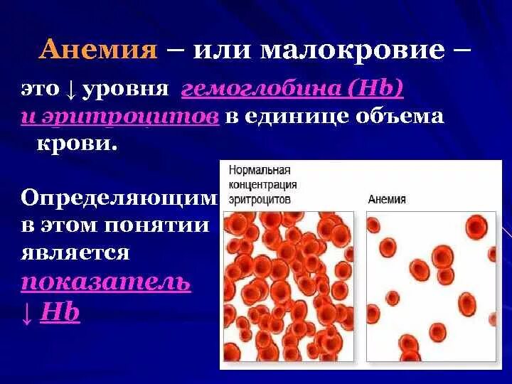 Назовите причины и способы лечения малокровия. Заболевание крови анемия. Анемия эритроциты.