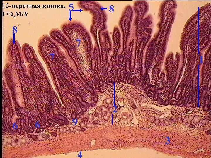 12 Перстная кишка гистология препарат. Двенадцатиперстная кишка гистология. Двенадцатиперстная кишка гистология препарат. Толстая кишка гистология препарат. Слизистая оболочка 12 кишки