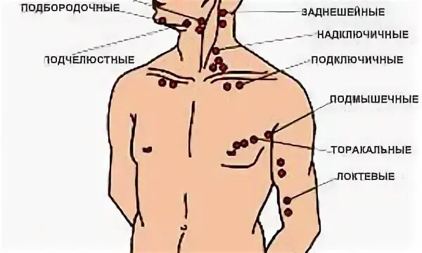Воспалился лимфоузел слева в паху у женщин. Воспалился лимфоузел слева в паху у женщин
