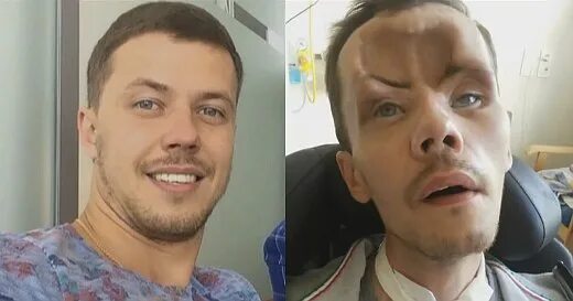 Парень стесняется своего тела. Парень стесняется своего тела