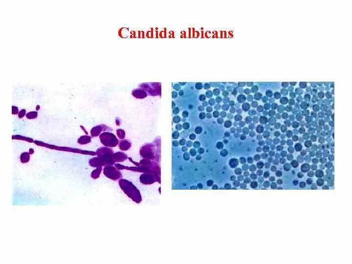 Грибы candida albicans. Candida альбиканс. Грибы Candida в мазке. Грибы рода кандида мазок. Кандида альбиканс в мазке.