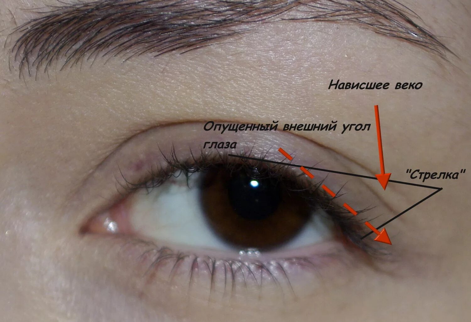 Верхняя стрелка. Стрелки на нависшее веко. Стрелки с нависшим веком. Стрелки доя опушенногоо уголка глаз. Наружный уголок глаза.