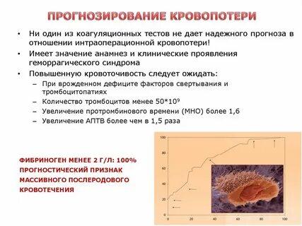 Массивная кровопотеря