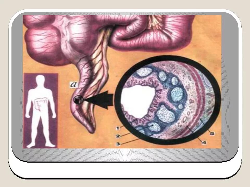 Строение аппендикса. Строение стенки аппендикса. Строение человека аппендикс.