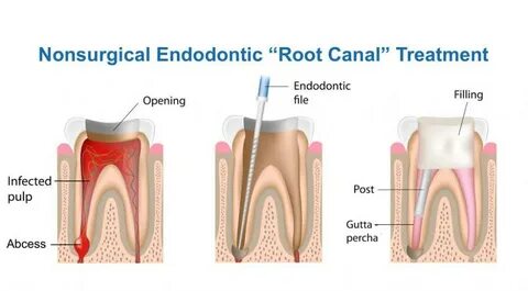 Dst root ca