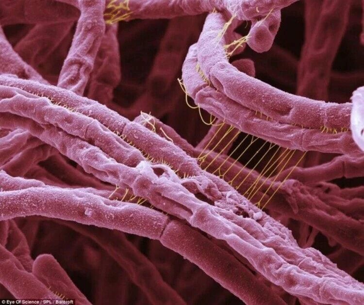 Как выглядит человек под микроскопом. Bacillus anthracis, а22 (сибирская язва). бацилла антрацис сибирская язва. бактерия сибирской язвы под микроскопом. сибиреязвенная бацилла микробиология.