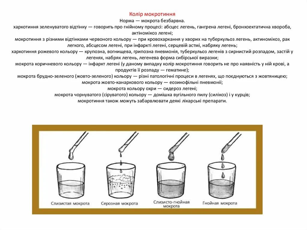 Мокрота передается. Мокрота таблица. Слизисто-гнойная гнойная и серозная мокрота. Мокрота норма.