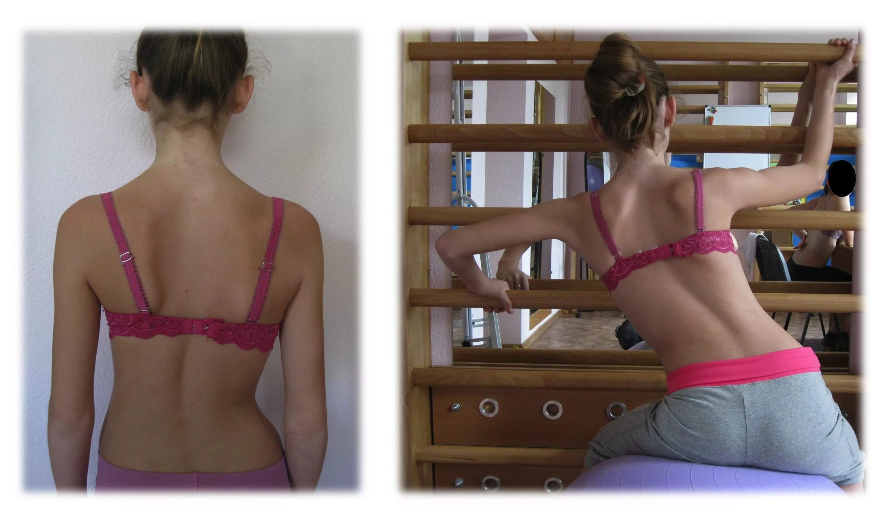 Сколиоз центр катарины шрот. Центр сколиоза катарины шрот. Сколиоз центр катарины шрот. Катарина шрот. Дыхательная гимнастика катарины шрот.