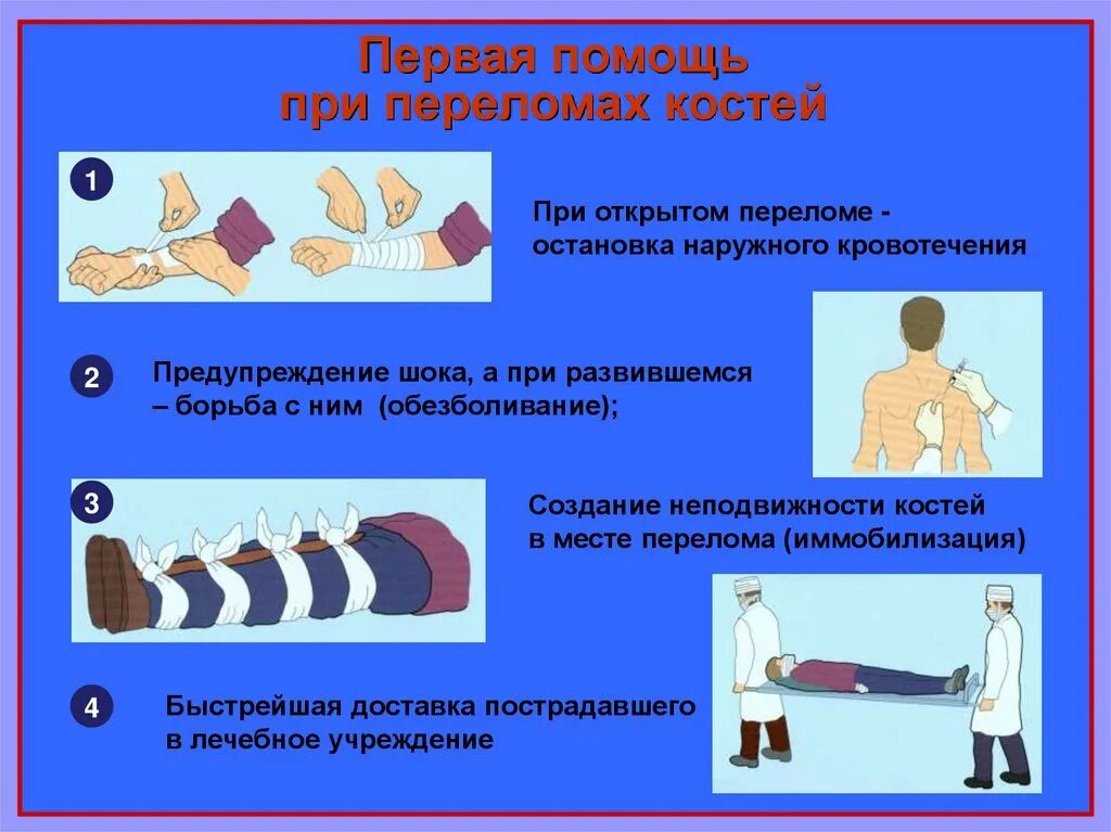 Какую первую помощь должен. При открытых переломах конечностей необходимо в первую очередь. ПМП при открытом и закрытом переломе. Алгоритм оказания первой помощи при открытом переломе ноги. Оказание первой помощи при открытом переломе и закрытом переломе.