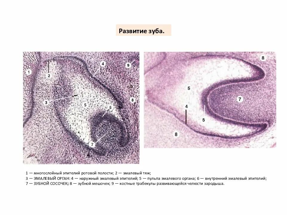 Стадии развития зуба. Ранняя стадия развития зуба гистология. Развитие зуба эмалевый орган гистология препарат. Развитие зуба 1 стадия гистология. Наружный эпителий эмалевого органа.