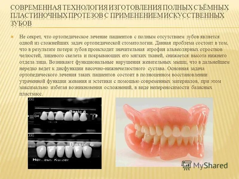 Функции протезирования. Методы ортопедической стоматологии. методы лечения при полном отсутствии зубов.. полное отсутствие зубов ортопедическая стоматология. задачи протезирования пациентов с полной потерей зубов.