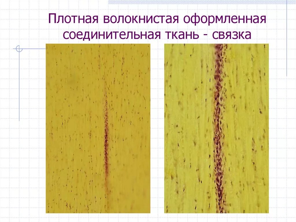 Плотная оформленная ткань. Плотная оформленная волокнистая соединительная ткань связка. Плотная эластическая соединительная ткань. Эластическая оформленная волокнистая соединительная ткань. Плотная оформленная соединительная ткань эластическая связка.