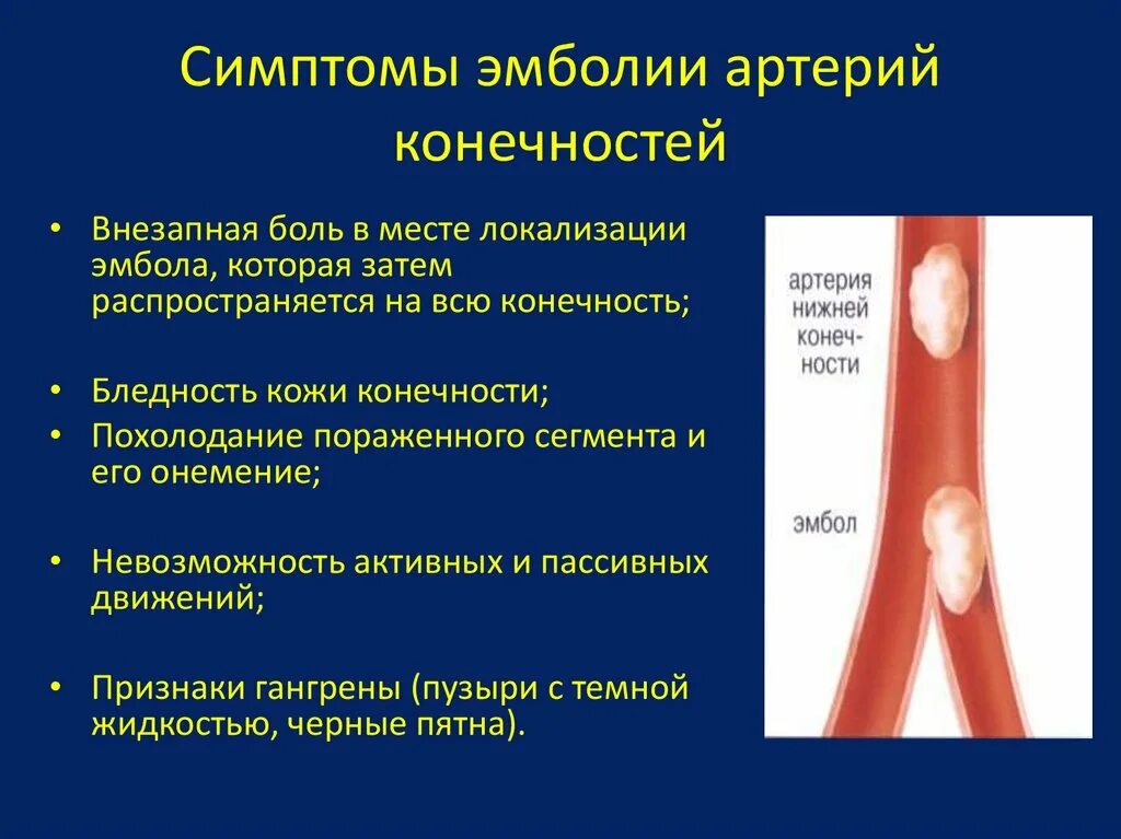 Эмболия бедренной артерии клиника. Острые тромбоэмболии артерий конечностей. Эмболия периферических артерий. Острые артериальные тромбозы и эмболии магистральных сосудов.