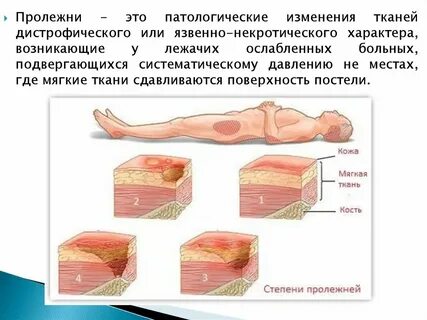 Пролежни причины