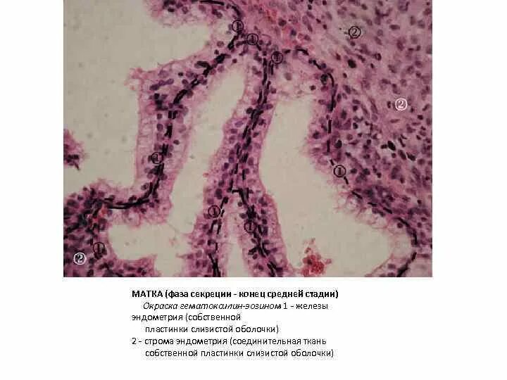 Фаза секреции эндометрия гистология. Железы Опитца гистология. Секреторный эндометрий гистология. Матка гематоксилин эозин. Эндометрия ранней секреции