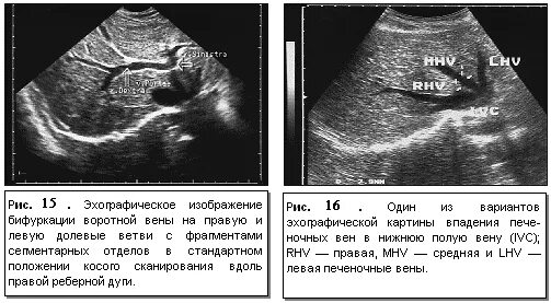 Нормы вен печени