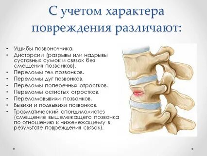 Переломы правых поперечных отростков