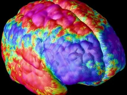 Small brain