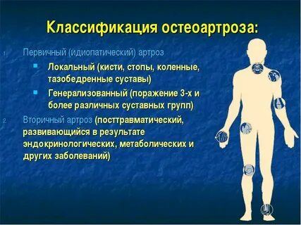 Остеоартроз код