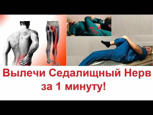 Седалищный нерв за 2 минут