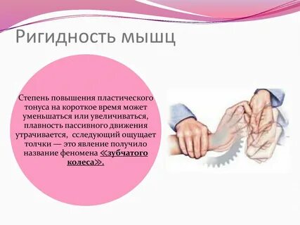 Зубчатый тонус