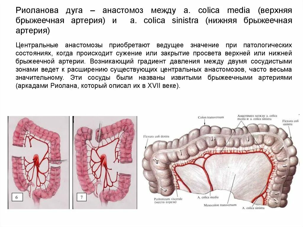 Синдром верхней брыжеечной артерии. Риоланова дуга анатомия. анастомозы брыжеечной артерии.