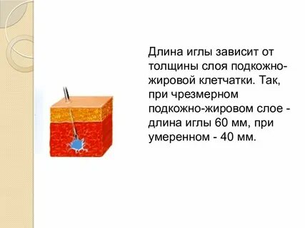 Длина иглы