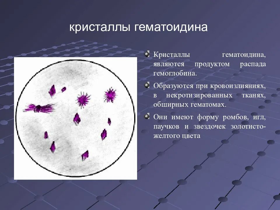 В мокроте можно обнаружить. Микроскопия мокроты Кристаллы гематоидина. Кристаллы гематоидина в мокроте под микроскопом. Микроскопия мокроты Кристаллы гемосидерина. Кристаллы гематоидина микроскопия кала.