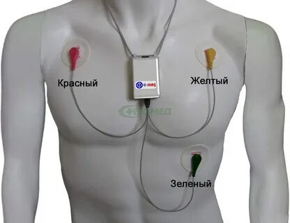 Экг красный желтый зеленый