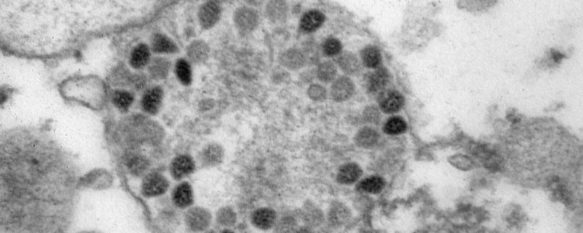 Коронавирус штаммы омикрон. Омикрон коронавирус. Новый вирус Омикрон.
