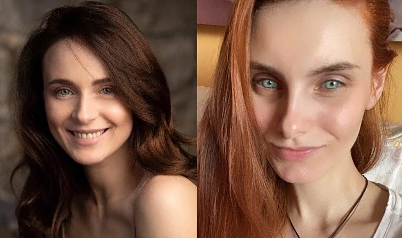 Куда уж меньше: всегда стройная Анна Снаткина стала в два раза худее WOMAN