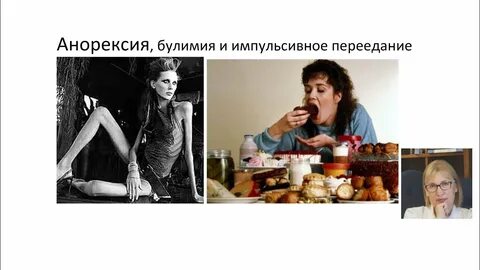 Анорексия и булимия