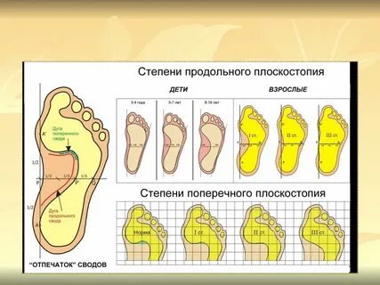 Состояние стоп