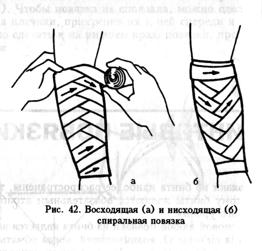 Колосовидная повязка на предплечье алгоритм. Спиральная повязка с перегибами техника наложения. Циркулярная повязка колосовидная. Техника наложения бинтовых повязок на руку. Как правильно перевязывать бинт