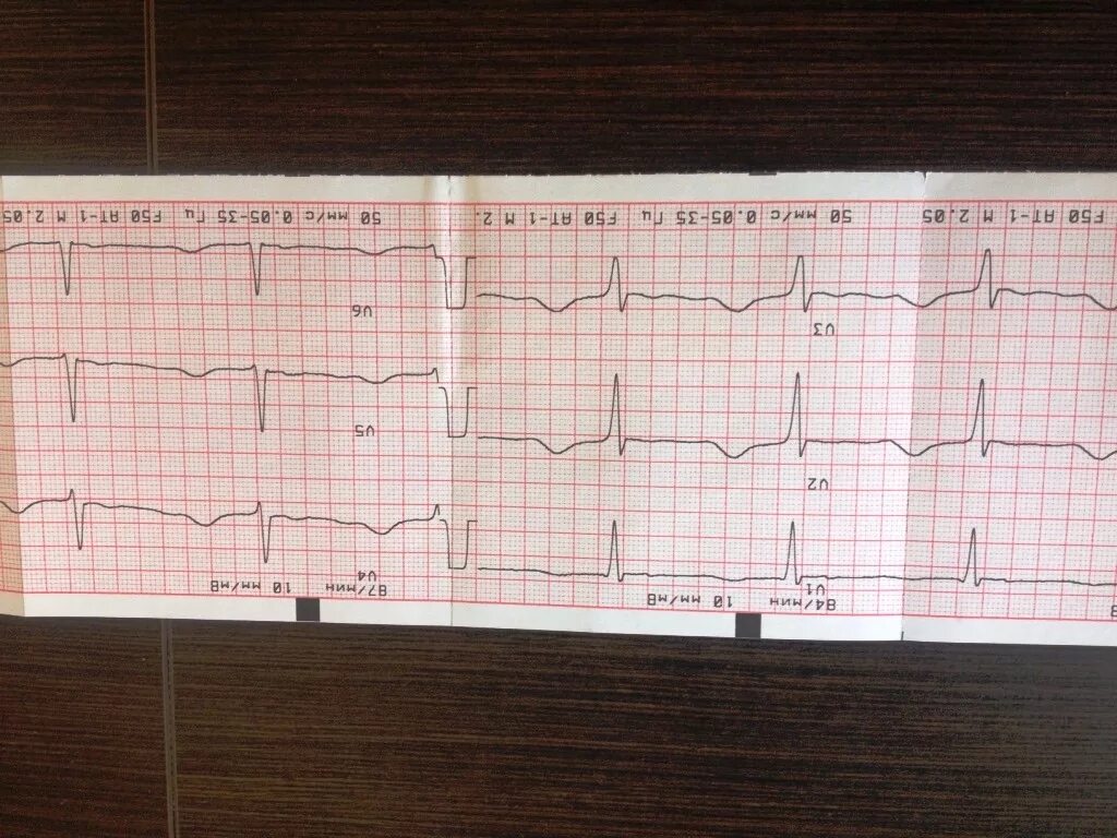 Creation of an ECG workbook with Scribus