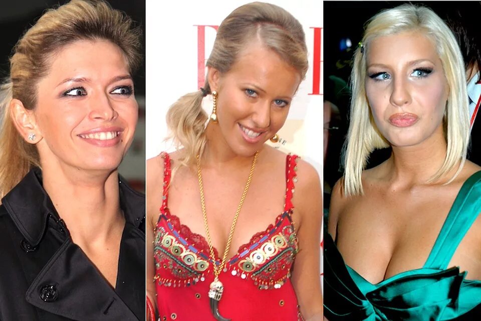 Ксения собчак ринопластика до и после. Ксения собчак ринопластика. Собчак ринопластика. Ксения собчак до пластики. Собчак ринопластика.