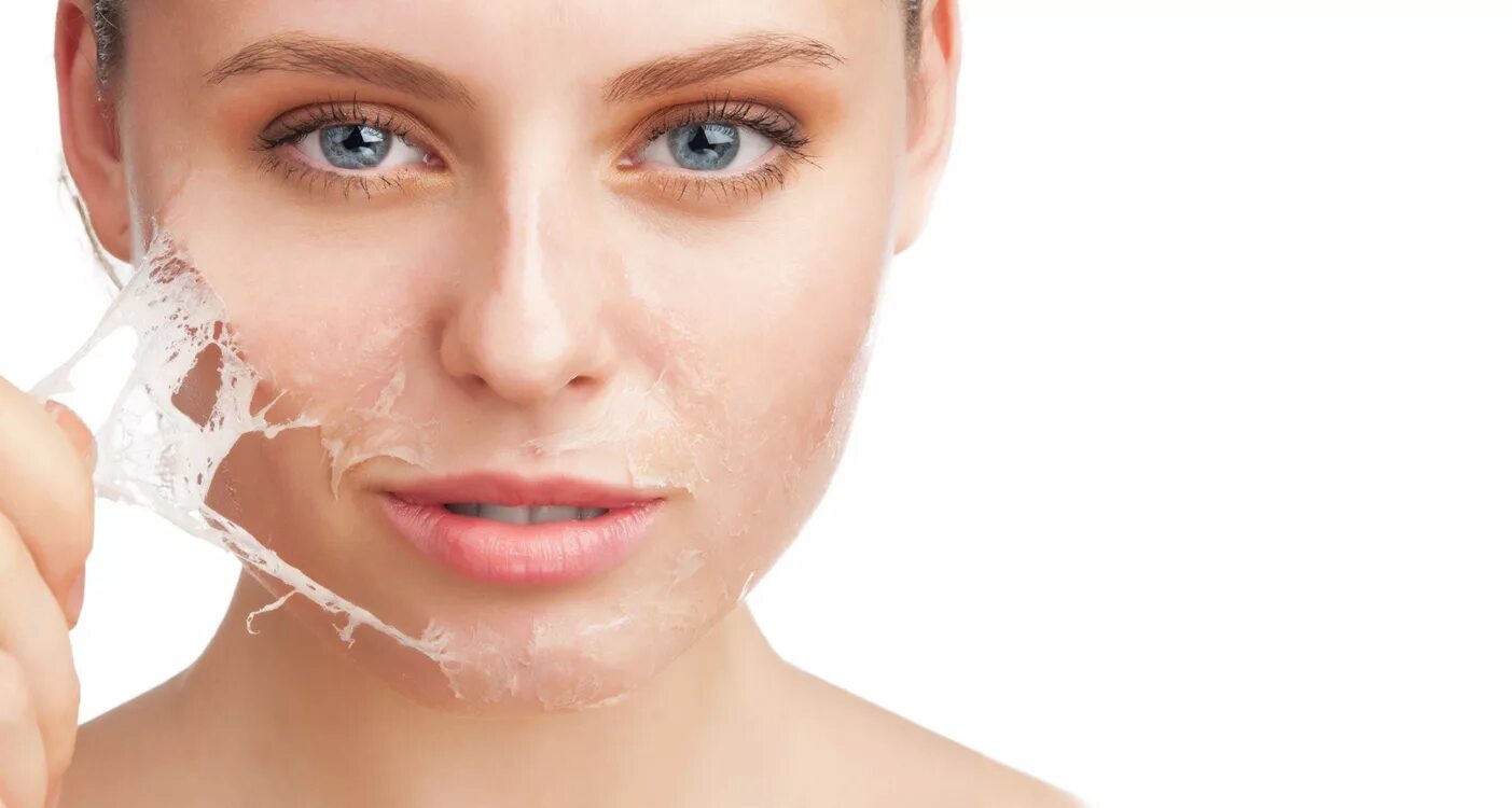 преимущество пилинга. химический пилинг. пилинг. преимущество пилинга. химический пилинг косметология.