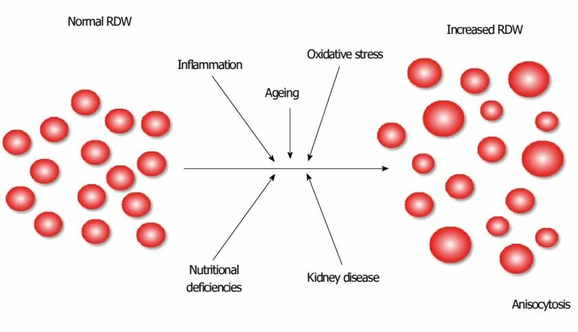Распределение эритроцитов. Rdw — red cell distribution. rdw (red cell distribution width) характеризует. rdw — red cell distribution — индекс распределения эритроцитов;. platelet distribution width.