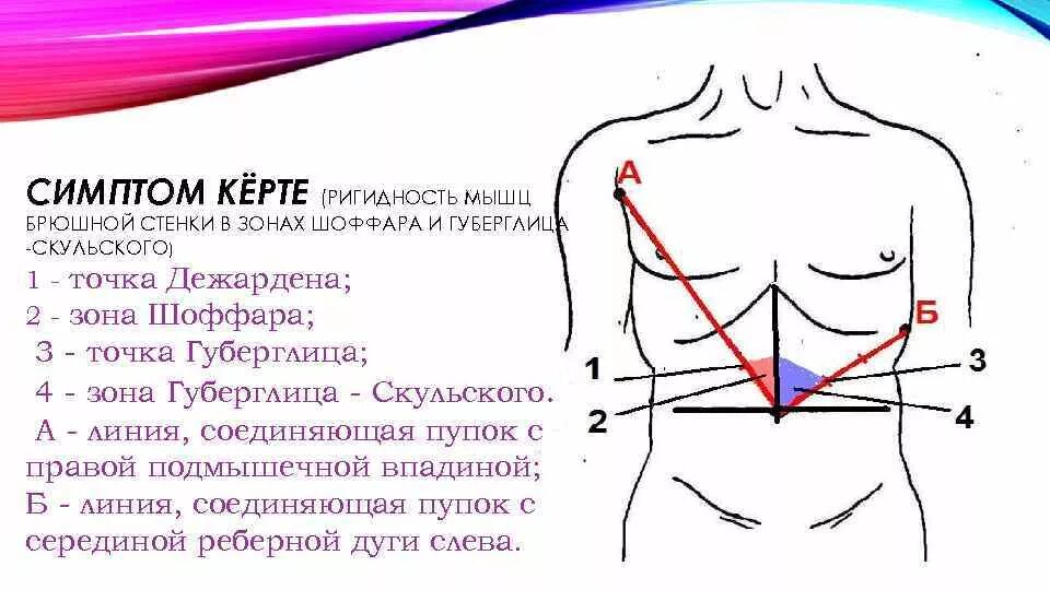 Проекция желчного пузыря на переднюю брюшную стенку