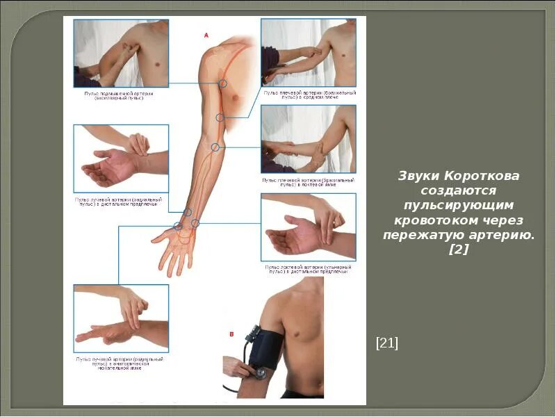Пульсация артерий верхних конечностей. Место пульсации плечевой артерии. Точки пальпации артерий. Места пальпации пульса на периферических артериях. Пульсация артерий стопы