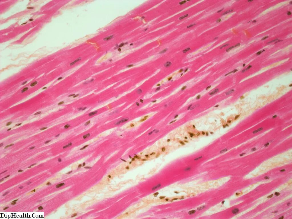 Гладкие мышцы многоядерные. Гладкая мышечная ткань гистология. Гладкая мышечная ткань микрофотография. Микрофотография скелетной мышечной ткани. Поперечно полосатая мышечная ткань гистология.