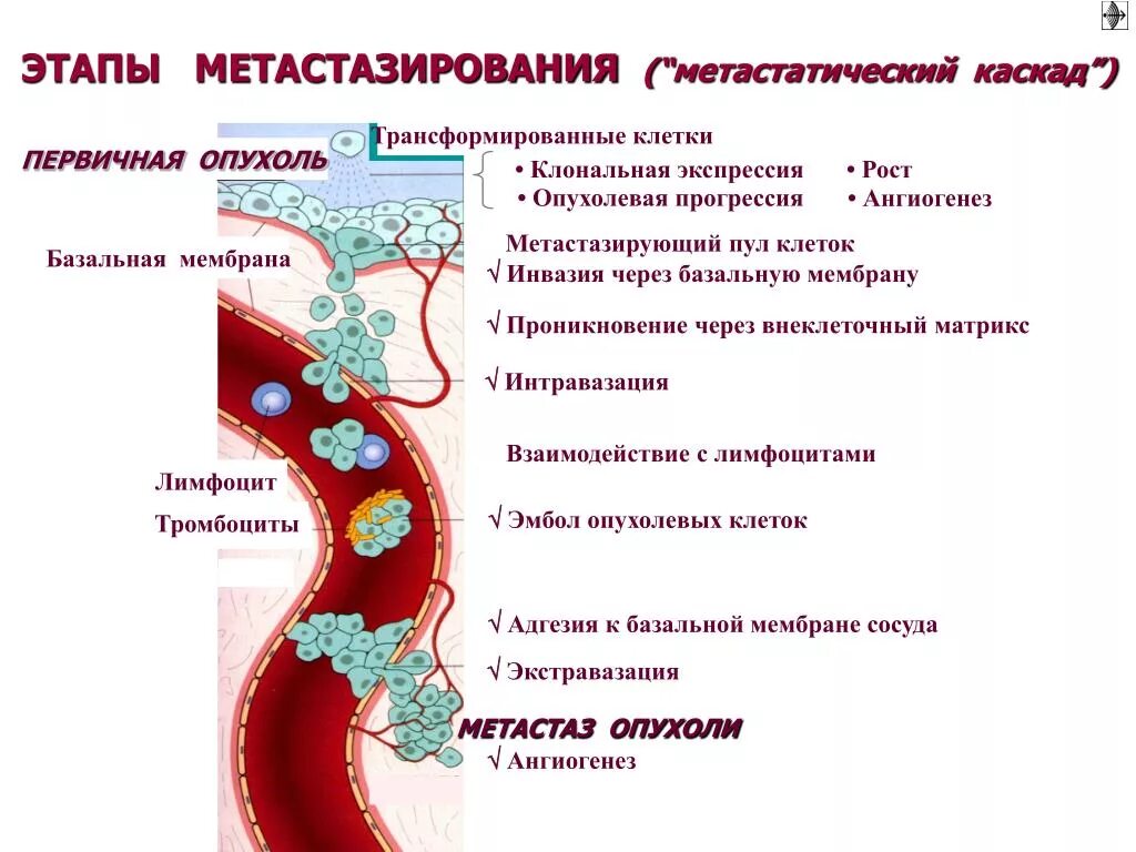 Метастазы раковых опухолей. Метастазирование опухолей. основные пути метастазирования опухолей. опухолевый ангиогенез. гематогенное метастазирование.