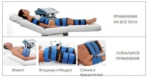 Миостимулятор тела отзывы