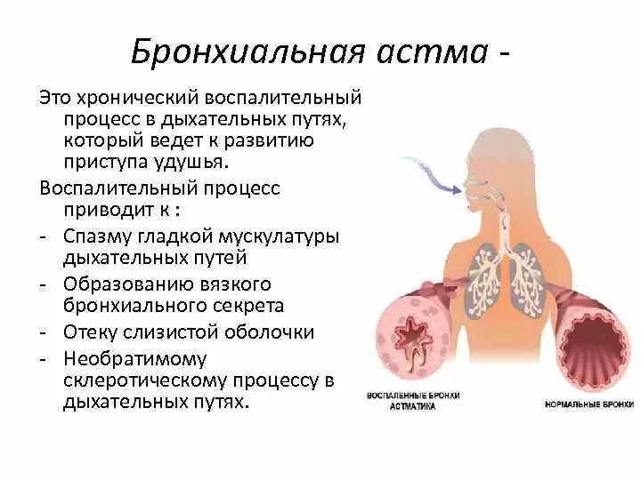 Бронхиальная астма. Бронхиальная астма презентация. Осложнения бронхиальной астмы. Бронхи при бронхиальной астме.