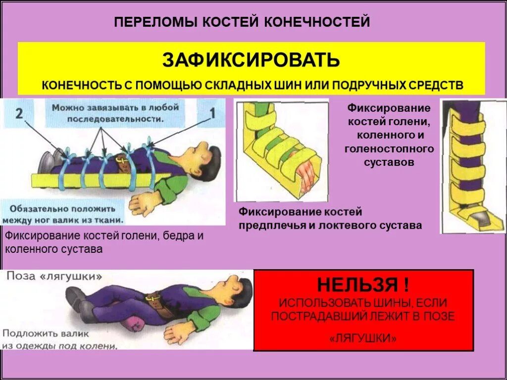 При открытом переломе следует. Оказание первой помощи при переломах конечностей. Оказание первой доврачебной помощи при переломах костей конечностей. Оказание первой медицинской помощи при переломе голени. Оказание первой помощи при закрытом переломе голени.